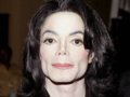 Michael Jackson多次隆鼻 小心鼻骨溃烂塌陷及秃头