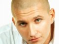 120万年轻人为雄性秃苦 医师吁治落发宜趁早