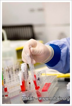 O型血 心臟病風險最低？