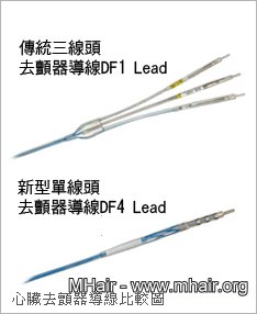 心臟去顫器導線比較圖