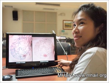 鬼頭刺青免費去除 青少年展開新生命