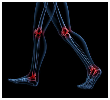少運動多外食 30萬輕熟女骨流失