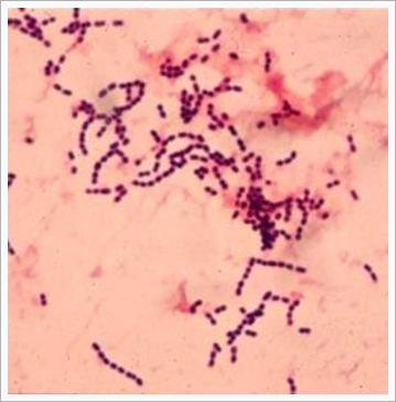 感染腦膜炎燒壞腦子？