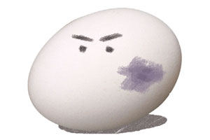 皮膚經常瘀青,如何改善?