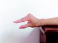 手指弯曲伸不直？电脑族、拇指族要小心
