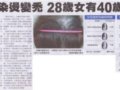 太常染烫变秃 28岁女有40岁头皮
